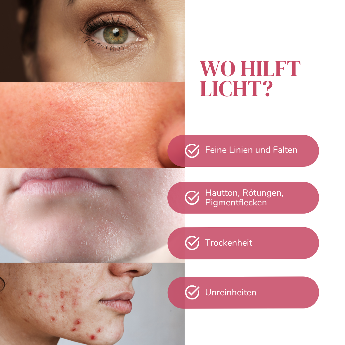 LEDPro Maske für gesunde, strahlende Haut