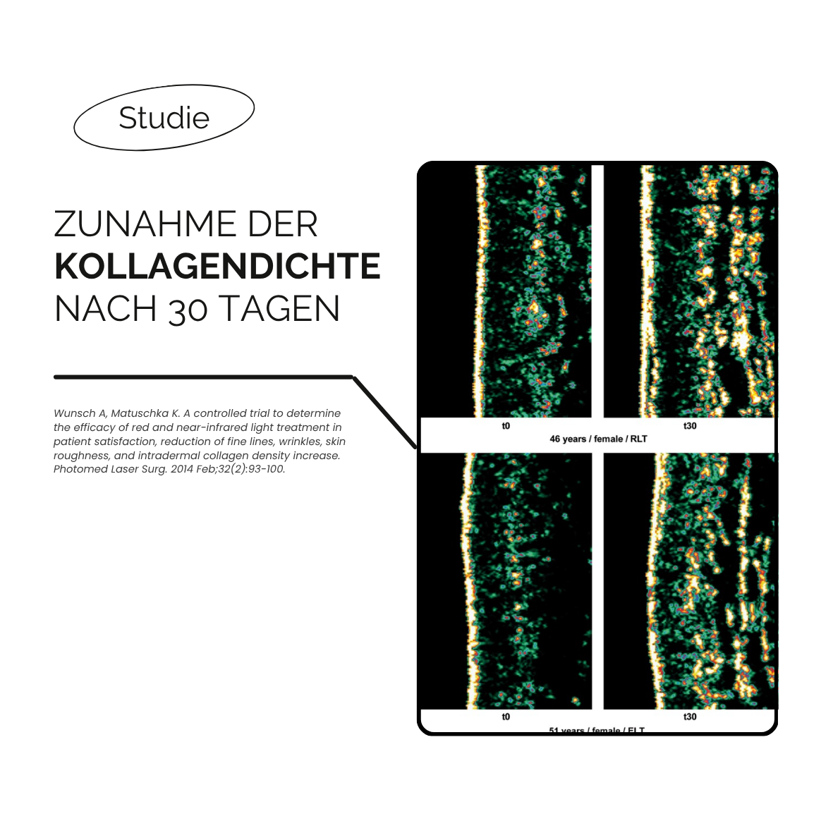 LED-Rotlicht-Gesichtsmaske-Maske-Hals-Dekollete-Bewertung-Review-kaufen-schweiz-therapie-studie